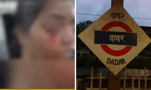 Dadar स्टेशन पर चलती लोकल ट्रेन पर पत्थर फेंके जाने से मुंबई की महिला की आंख में चोट लगी Dadar स्टेशन पर चलती लोकल ट्रेन पर पत्थर फेंके जाने से मुंबई की महिला की आंख में चोट लगी