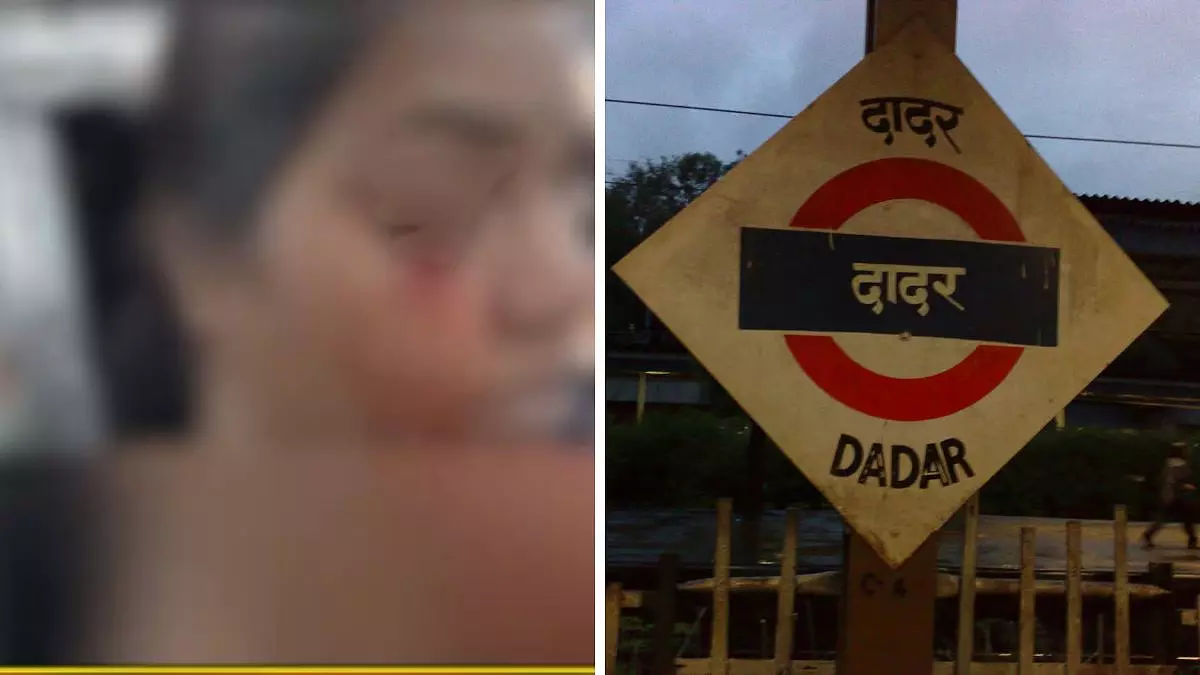 Dadar स्टेशन पर चलती लोकल ट्रेन पर पत्थर फेंके जाने से मुंबई की महिला की आंख में चोट लगी Dadar स्टेशन पर चलती लोकल ट्रेन पर पत्थर फेंके जाने से मुंबई की महिला की आंख में चोट लगी