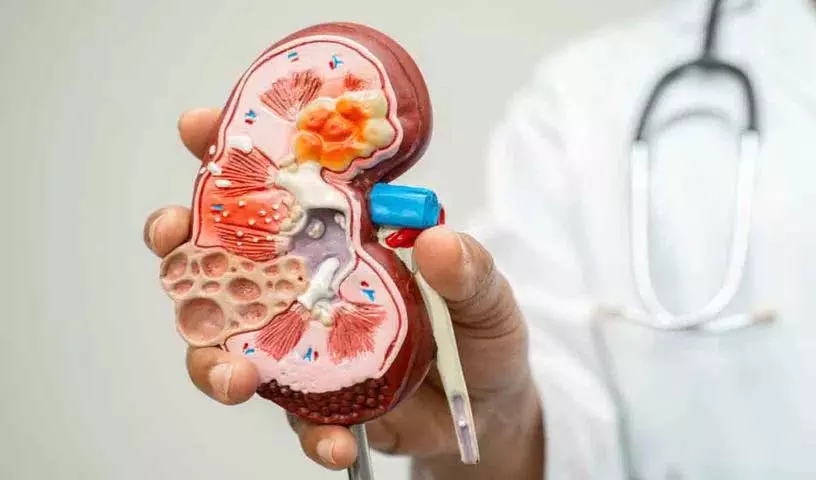 भारत में Kidney की बीमारियां बढ़ रही हैं; एक्सपर्ट्स 30 साल की उम्र से स्क्रीनिंग की सलाह भारत में Kidney की बीमारियां बढ़ रही हैं; एक्सपर्ट्स 30 साल की उम्र से स्क्रीनिंग की सलाह