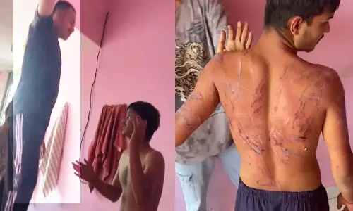Raipur Breaking: साहस नशा मुक्ति केंद्र में मरीज़ के साथ मारपीट, FIR दर्ज Raipur Breaking: साहस नशा मुक्ति केंद्र में मरीज़ के साथ मारपीट, FIR दर्ज