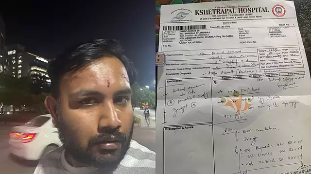 Bengaluru road rage: ऑटो ड्राइवर ने कार ड्राइवर पर हमला किया Bengaluru road rage: ऑटो ड्राइवर ने कार ड्राइवर पर हमला किया