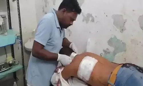 बदमाशों का उत्पात, बाइक विवाद में युवक पर चाकू से हमला बदमाशों का उत्पात, बाइक विवाद में युवक पर चाकू से हमला