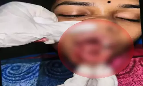 CG: चलती कार पर पथराव, युवती गंभीर घायल