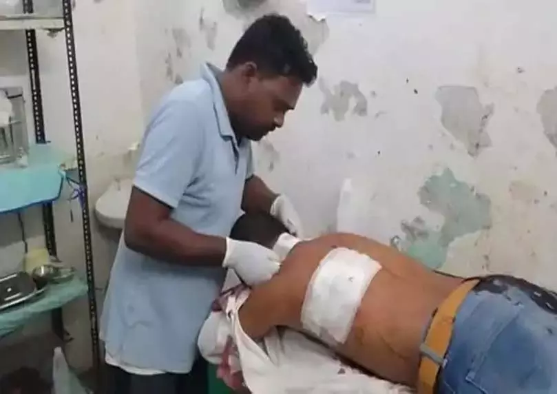 बदमाशों का उत्पात, बाइक विवाद में युवक पर चाकू से हमला बदमाशों का उत्पात, बाइक विवाद में युवक पर चाकू से हमला