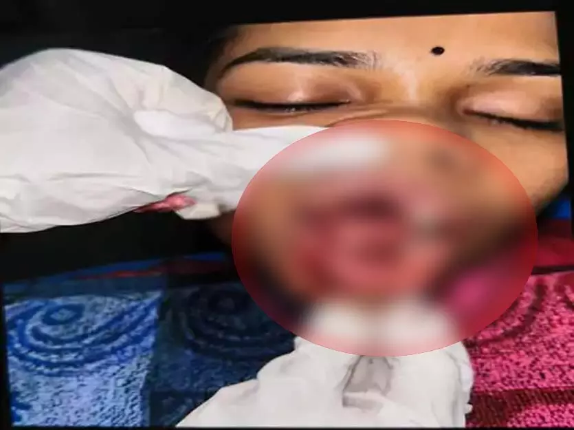 CG: चलती कार पर पथराव, युवती गंभीर घायल CG: चलती कार पर पथराव, युवती गंभीर घायल