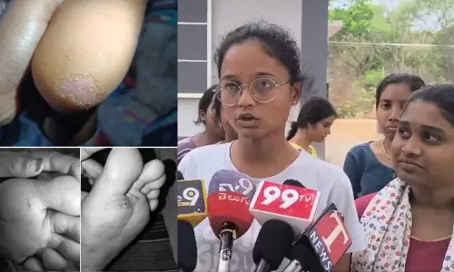Kakatiya University के स्टूडेंट्स ने हॉस्टल में चूहों के काटने और लापरवाही की शिकायत Kakatiya University के स्टूडेंट्स ने हॉस्टल में चूहों के काटने और लापरवाही की शिकायत
