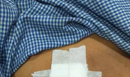 मंदिर परिसर में चाकूबाजी, भाठागांव का मामला मंदिर परिसर में चाकूबाजी, भाठागांव का मामला