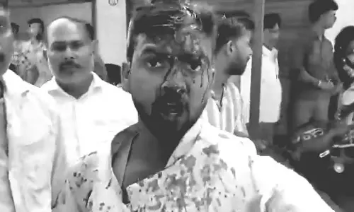 UP: शादी की रात दुल्हन के कथित हमले में दूल्हा घायल UP: शादी की रात दुल्हन के कथित हमले में दूल्हा घायल