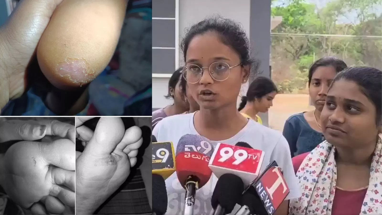 Kakatiya University के स्टूडेंट्स ने हॉस्टल में चूहों के काटने और लापरवाही की शिकायत Kakatiya University के स्टूडेंट्स ने हॉस्टल में चूहों के काटने और लापरवाही की शिकायत