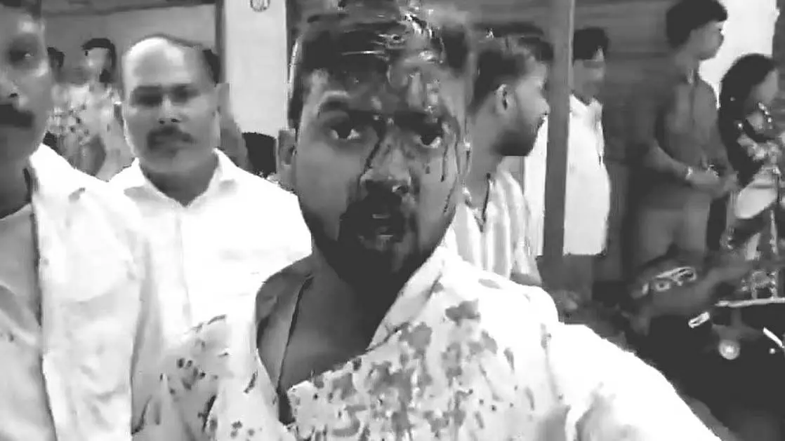 UP: शादी की रात दुल्हन के कथित हमले में दूल्हा घायल UP: शादी की रात दुल्हन के कथित हमले में दूल्हा घायल