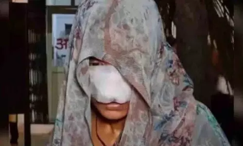 Hamirpur Crime: झगड़े के बाद पति ने पत्नी का चेहरा काटा, 10 टांके लगे Hamirpur Crime: झगड़े के बाद पति ने पत्नी का चेहरा काटा, 10 टांके लगे
