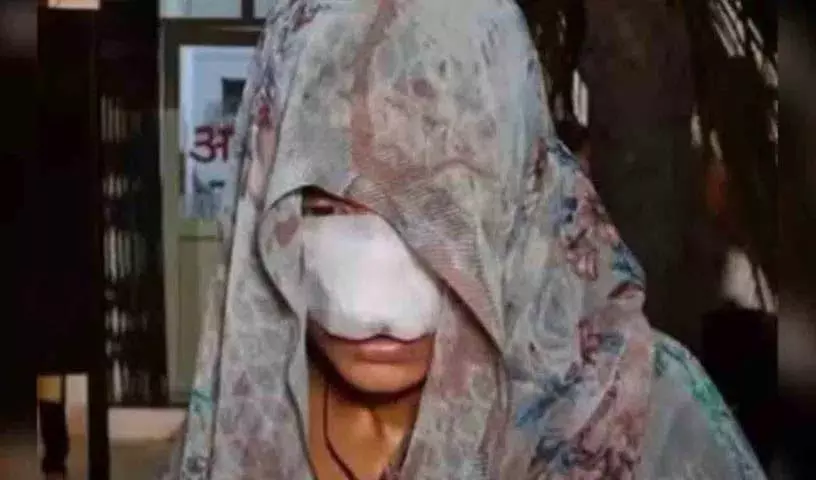 Hamirpur Crime: झगड़े के बाद पति ने पत्नी का चेहरा काटा, 10 टांके लगे Hamirpur Crime: झगड़े के बाद पति ने पत्नी का चेहरा काटा, 10 टांके लगे