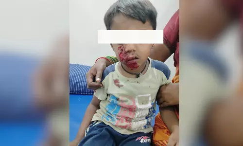 Telangana: नलगोंडा में खेलते समय चार साल के बच्चे पर आवारा कुत्ते ने किया हमला