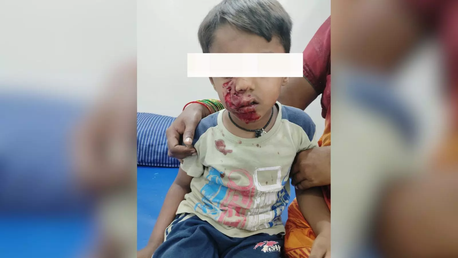 Telangana: नलगोंडा में खेलते समय चार साल के बच्चे पर आवारा कुत्ते ने किया हमला Telangana: नलगोंडा में खेलते समय चार साल के बच्चे पर आवारा कुत्ते ने किया हमला