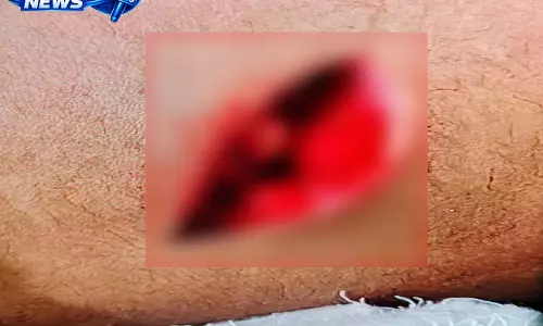 शयाम नगर में मोबाइल शॉप संचालक पर सरेराह चाकूबाजी, आरोपी फरार