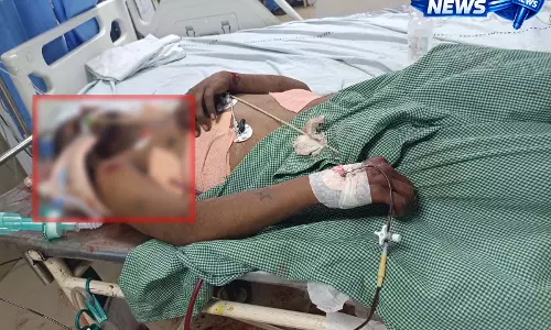 सड्डू इलाके में एक्टीवा लेन-देन विवाद में चाकूबाजी, युवक गंभीर सड्डू इलाके में एक्टीवा लेन-देन विवाद में चाकूबाजी, युवक गंभीर