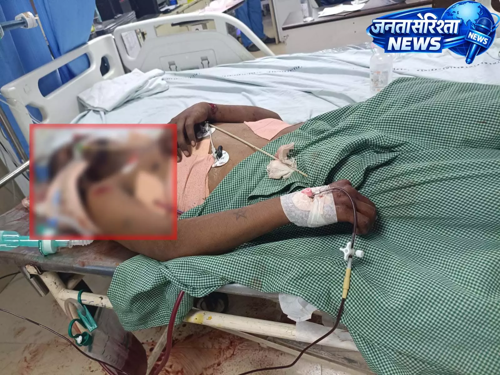 सड्डू इलाके में एक्टीवा लेन-देन विवाद में चाकूबाजी, युवक गंभीर सड्डू इलाके में एक्टीवा लेन-देन विवाद में चाकूबाजी, युवक गंभीर
