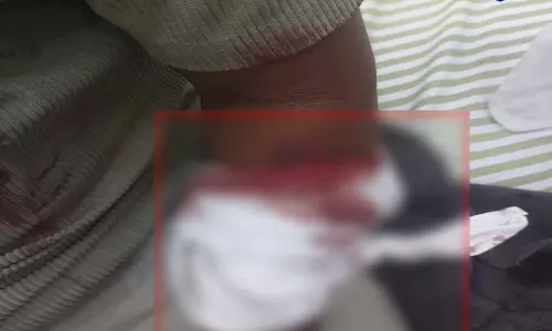 सेमरिया बाजार चौक पर चाकूबाजी, युवक घायल सेमरिया बाजार चौक पर चाकूबाजी, युवक घायल