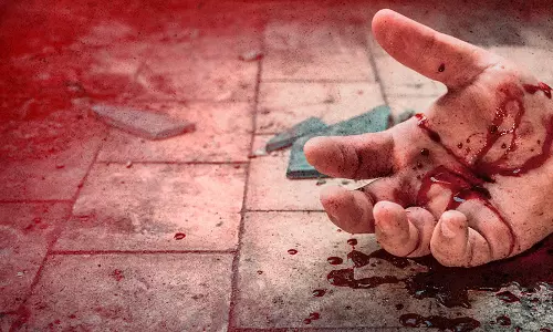 Mumbai : मलाड ईस्ट में तेज़ रफ़्तार मोटरसाइकिल की टक्कर से पैदल यात्री की मौत Mumbai : मलाड ईस्ट में तेज़ रफ़्तार मोटरसाइकिल की टक्कर से पैदल यात्री की मौत