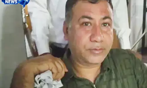 CG: कंपनी गार्डन में मधुमक्खियों का हमला, 25 से ज्यादा लोग घायल