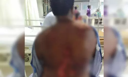 नर्मदा कोल्ड्रिंक फैक्ट्री में अमोनिया गैस से मजदूर गंभीर रूप से झुलसा नर्मदा कोल्ड्रिंक फैक्ट्री में अमोनिया गैस से मजदूर गंभीर रूप से झुलसा