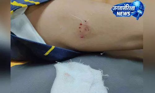 Kerala : कुत्ते के काटने से आठ साल का बच्चा घायल