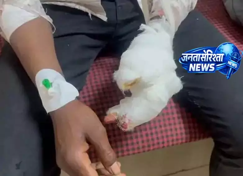 गन्ना जूस मशीन में फंसा 16 वर्षीय नाबालिग का हाथ, चार उंगलियां गंभीर गन्ना जूस मशीन में फंसा 16 वर्षीय नाबालिग का हाथ, चार उंगलियां गंभीर