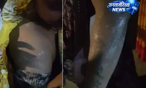 किचन में लगी आग, गैस सिलेंडर का पाइप फटने से हुई बड़ी घटना, कई घायल किचन में लगी आग, गैस सिलेंडर का पाइप फटने से हुई बड़ी घटना, कई घायल