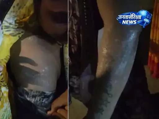 किचन में लगी आग, गैस सिलेंडर का पाइप फटने से हुई बड़ी घटना, कई घायल किचन में लगी आग, गैस सिलेंडर का पाइप फटने से हुई बड़ी घटना, कई घायल