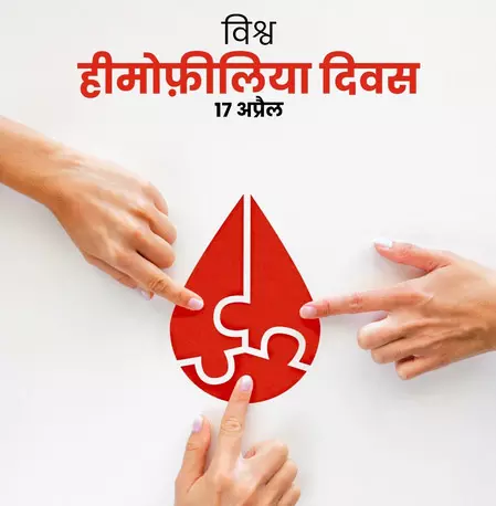 हीमोफीलिया के लक्षणों को न करें नजरअंदाज, समय पर जांच बचा सकती है जीवन हीमोफीलिया के लक्षणों को न करें नजरअंदाज, समय पर जांच बचा सकती है जीवन