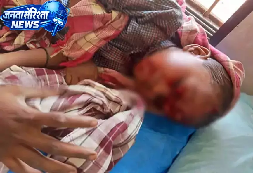 4 साल के मासूम पर आवारा कुत्ते का हमला, सिर-मुंह समेत 17 जगह गंभीर जख्म 4 साल के मासूम पर आवारा कुत्ते का हमला, सिर-मुंह समेत 17 जगह गंभीर जख्म