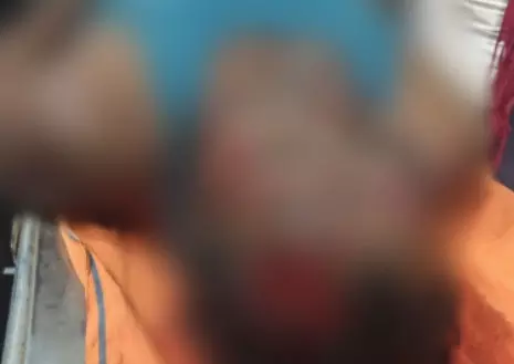 सेंट्रिग कर रहे मिस्त्री की मौत, बिजली पोल से झुलसा सेंट्रिग कर रहे मिस्त्री की मौत, बिजली पोल से झुलसा