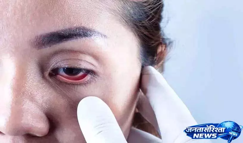 भारत में Glaucoma के मामले बढ़ रहे हैं, इन शुरुआती लक्षणों को ज़रूर पहचानें भारत में Glaucoma के मामले बढ़ रहे हैं, इन शुरुआती लक्षणों को ज़रूर पहचानें