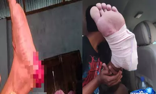 Ukhrul: सिनाकेइथेई का नागा युवक फायरिंग में घायल Ukhrul: सिनाकेइथेई का नागा युवक फायरिंग में घायल