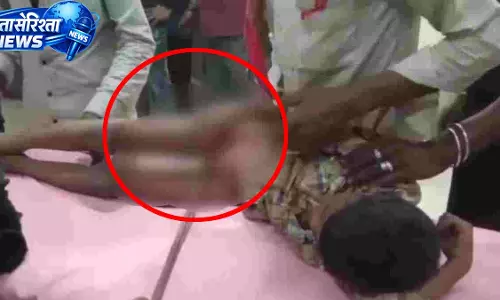 खेलते समय लोहे की सरिया में गिरा 6 वर्षीय बच्चा, प्राइवेट पार्ट में फंसी रॉड खेलते समय लोहे की सरिया में गिरा 6 वर्षीय बच्चा, प्राइवेट पार्ट में फंसी रॉड