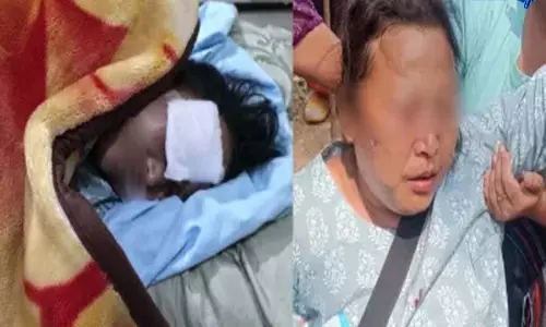 Manipur: उखरुल के तालुई गांव में AR काफिले की टक्कर, दो घायल Manipur: उखरुल के तालुई गांव में AR काफिले की टक्कर, दो घायल