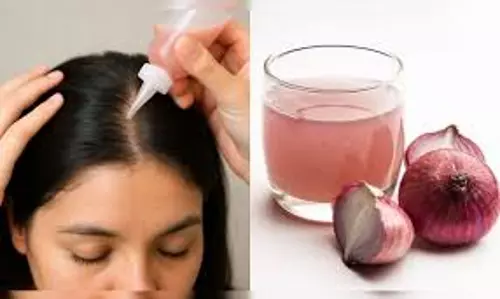 हेयर फॉल से छुटकारा: प्याज के रस में मिलाएं ये 2 घरेलू चीजें, मिलेगा बेहतर रिजल्ट हेयर फॉल से छुटकारा: प्याज के रस में मिलाएं ये 2 घरेलू चीजें, मिलेगा बेहतर रिजल्ट
