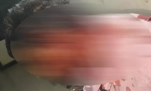 एयरपोर्ट के बाहर ऑटो चालक पर हमला, गंभीर रूप से घायल