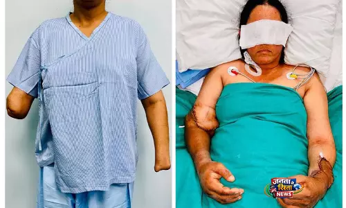 भूसा काटने वाली मशीन के हादसे में अपने दोनों हाथ गंवाने वाली एक युवा माँ को हैंड ट्रांसप्लांट से नई ज़िंदगी मिली भूसा काटने वाली मशीन के हादसे में अपने दोनों हाथ गंवाने वाली एक युवा माँ को हैंड ट्रांसप्लांट से नई ज़िंदगी मिली