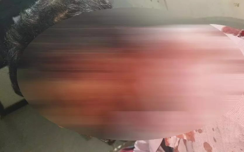 एयरपोर्ट के बाहर ऑटो चालक पर हमला, गंभीर रूप से घायल एयरपोर्ट के बाहर ऑटो चालक पर हमला, गंभीर रूप से घायल