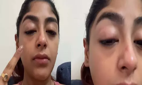 स्प्लिट्सविला X16 की प्रीत सिंह ने मुंबई के क्लब में हमले का आरोप, सूजी आंखों का वीडियो साझा किया