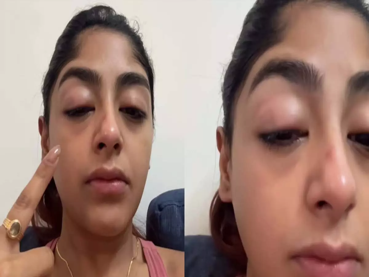 स्प्लिट्सविला X16 की प्रीत सिंह ने मुंबई के क्लब में हमले का आरोप, सूजी आंखों का वीडियो साझा किया स्प्लिट्सविला X16 की प्रीत सिंह ने मुंबई के क्लब में हमले का आरोप, सूजी आंखों का वीडियो साझा किया