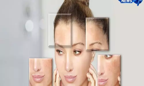 डर्मेटोलॉजिस्ट.... एक स्किनकेयर रूटीन काफी नहीं है! वायरल स्किन-ज़ोनिंग ट्रेंड के बारे में और जानें डर्मेटोलॉजिस्ट.... एक स्किनकेयर रूटीन काफी नहीं है! वायरल स्किन-ज़ोनिंग ट्रेंड के बारे में और जानें