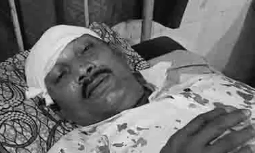 टीएमसी के बदमाशों ने मेरे सिर पर रॉड से वार किया : भाजपा पोलिंग एजेंट