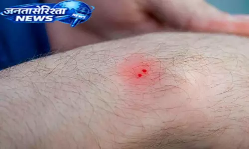 Kerala : इडुक्की में दो लोगों को सांप ने काटा Kerala : इडुक्की में दो लोगों को सांप ने काटा