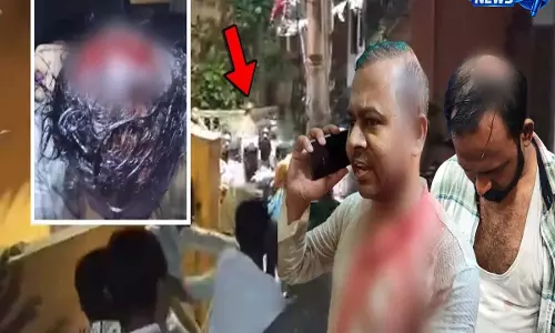 Bengal post-poll tension: बेहाला में RSS कार्यकर्ता पर हमला, सिर में गंभीर चोट और घर में तोड़फोड़ Bengal post-poll tension: बेहाला में RSS कार्यकर्ता पर हमला, सिर में गंभीर चोट और घर में तोड़फोड़