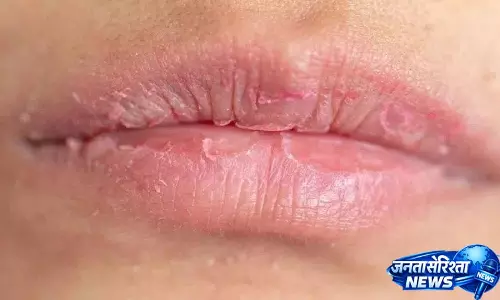 अगर आपको अक्सर Dry Lips की समस्या होती है तो ये उपाय अपनाएं अगर आपको अक्सर Dry Lips की समस्या होती है तो ये उपाय अपनाएं