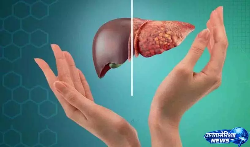 Fatty Liver वाले लोगों के लिए सबसे अच्छे तेल: हेल्थ बेनिफिट्स जो आपको पता होने चाहिए Fatty Liver वाले लोगों के लिए सबसे अच्छे तेल: हेल्थ बेनिफिट्स जो आपको पता होने चाहिए
