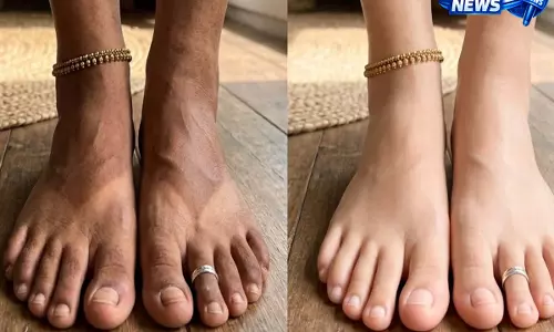 धूप से टैनिंग और चप्पल के निशान? इन घरेलू उपायों से मिनटों में पाएं पार्लर जैसी चमक