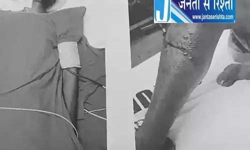 घायल युवक के ऑपरेशन में लापरवाही, नस कट जाने से मौत